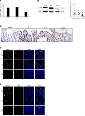 An essential role of adenosine deaminase acting on RNA 1 in coeliac disease mucosa